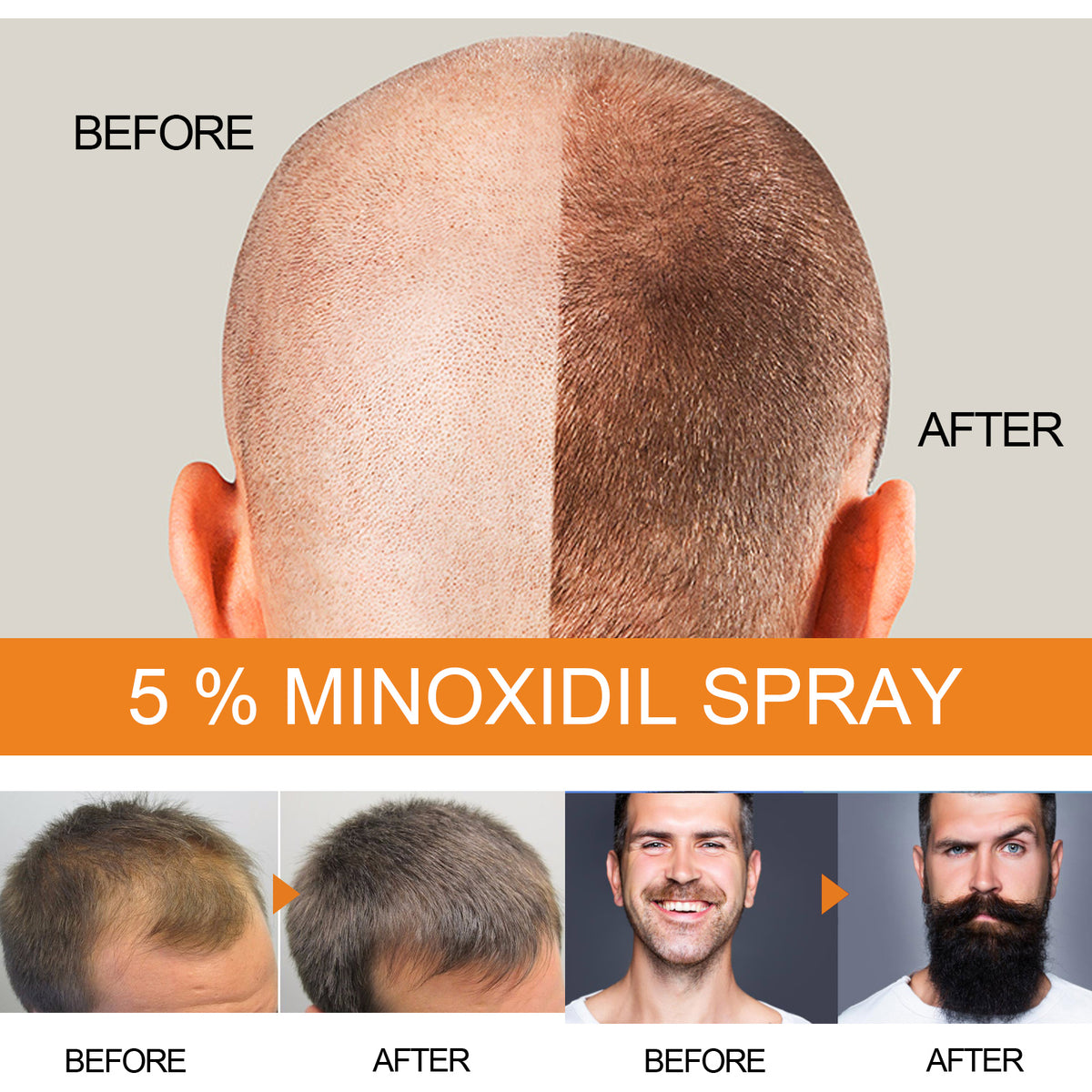 Men's Hair & Beard Growth Spray