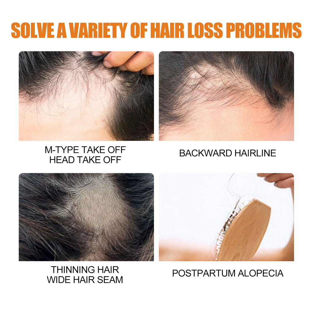 Men's Hair & Beard Growth Spray
